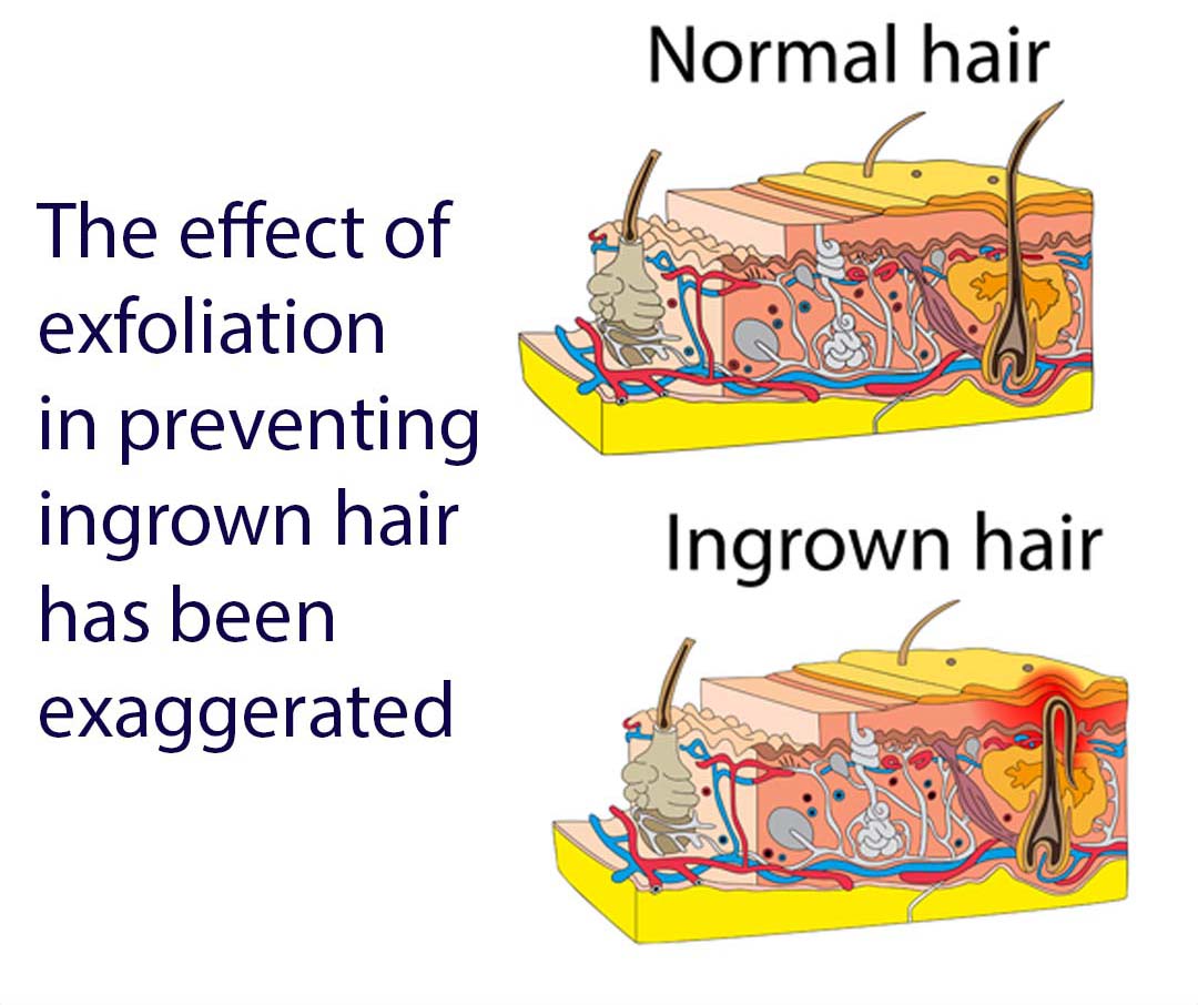 Exfoliation’s Effect on Preventing Ingrown Hair Has Been Exaggerated