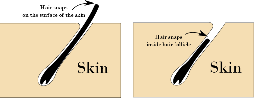 Snapping Split Hairs The Debate on the Direction of Hard and Soft Wax Hair Removal | Beauty ...